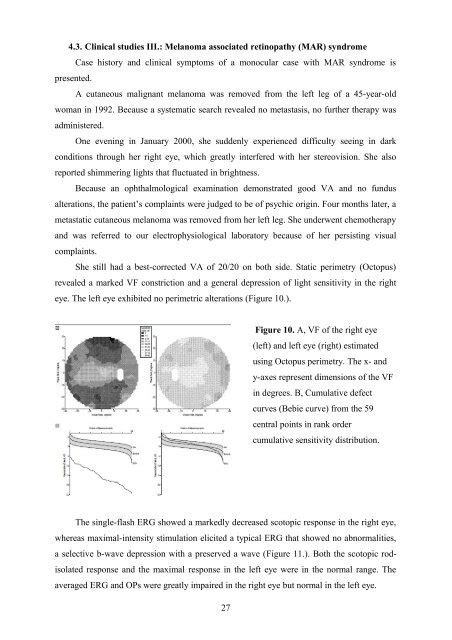 Image result for Concentric Visual Field Defect