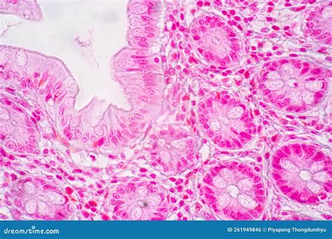 Afbeeldingsresultaten voor Human Small Intestine Tissue