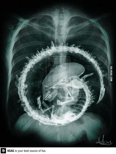 Image result for Alien Inside My Stomach