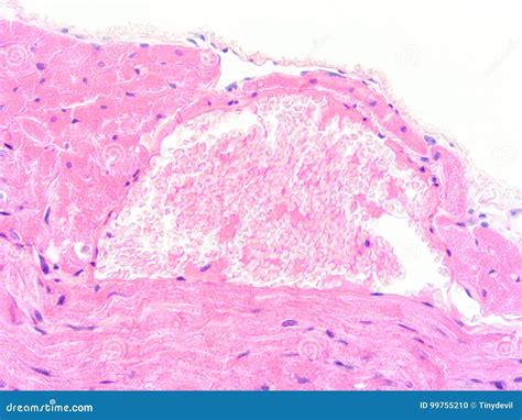 Heart Muscle Tissue に対する画像結果