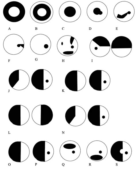 Image result for Types of Visual Field Defects