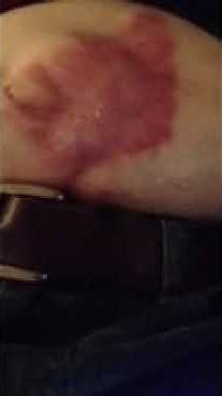 Image result for Alien Inside My Stomach