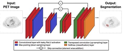 Machine Learning in Pet Scan Workflow に対する画像結果