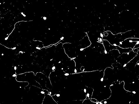 PCR Plate Image Well Detection Python-Opencv Stack Overflow に対する画像結果