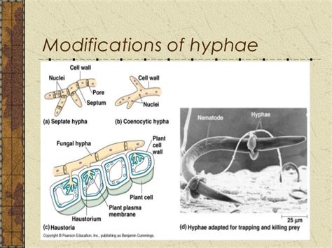 Flow Chart of Alexopoulos and Mims Classification に対する画像結果