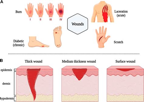 Image result for Wound Tissue Types