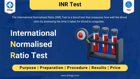 Image result for Array INR