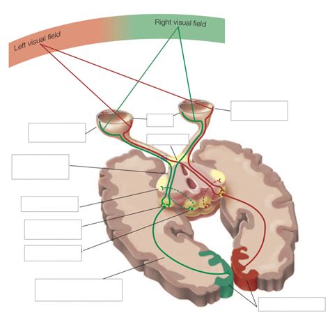 Image result for Optic Chiasm Visual Field