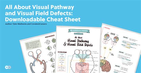 Image result for Visual Field Defects Cheat Sheet