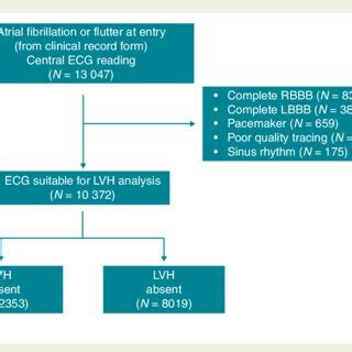 Image result for LBB ECG