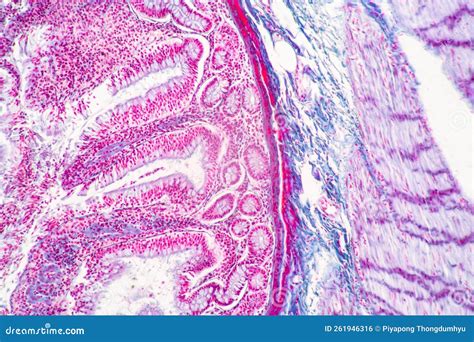 Afbeeldingsresultaten voor Human Small Intestine Tissue