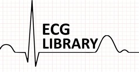 Image result for LBB ECG