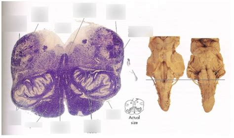 Image result for Rostral Dex