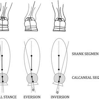 Subtalar Inversion に対する画像結果