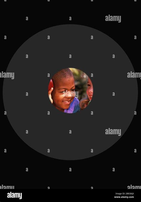 Tunnel Vision Visual Field Glaucoma に対する画像結果