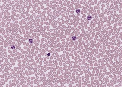 Image result for Tissue Blood Layers