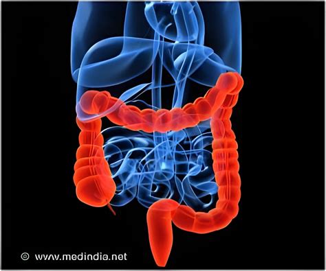 Image result for Ver Intestinal