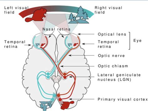 Image result for Visual Field Defects