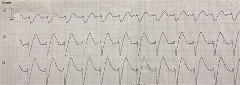 Rosc Algorithm に対する画像結果