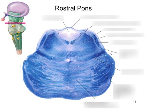 Image result for Rostral Dex