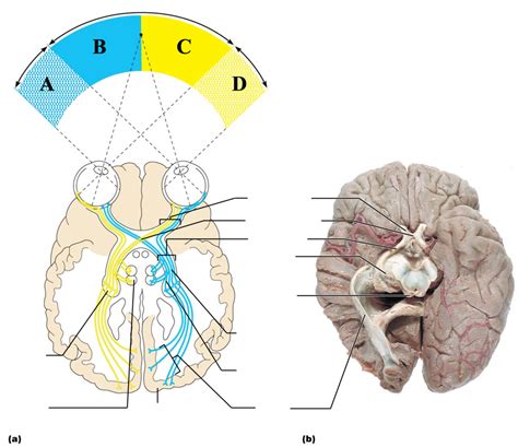Visual Pathway Brain-साठीचा प्रतिमा निकाल