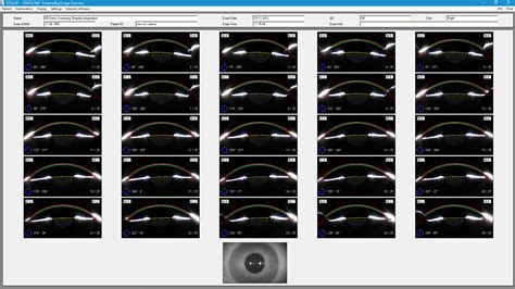 Image result for MATLAB Pentacam