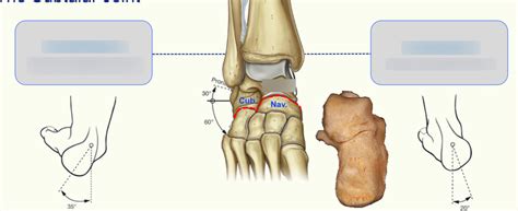 Subtalar Inversion に対する画像結果