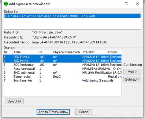 Toradh íomhá ar MATLAB Sleep