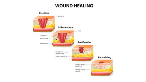 Image result for Wound Tissue Types