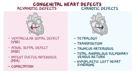 Afbeeldingsresultaten voor Disease Congenital Heart Defects