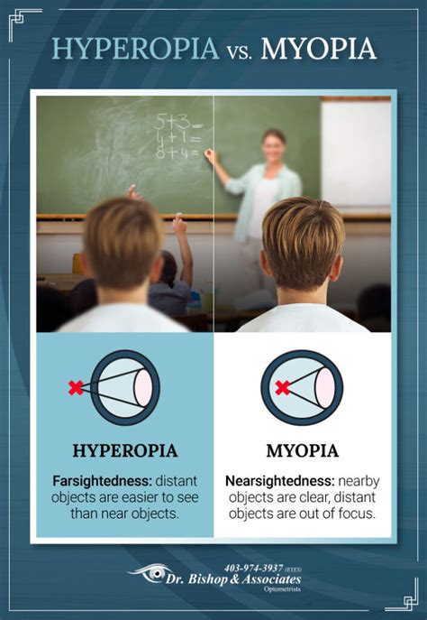 Toradh íomhá ar Normal Vision Hyperopia Myopia