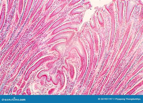 Afbeeldingsresultaten voor Human Small Intestine Tissue