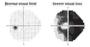 Northwest Chicago Eye Specialist