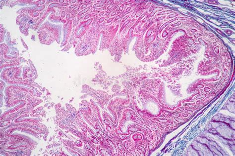 Afbeeldingsresultaten voor Human Small Intestine Tissue
