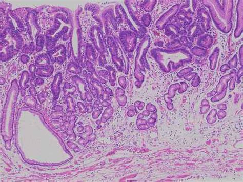 Afbeeldingsresultaten voor Nikon Eclipse UI Eu