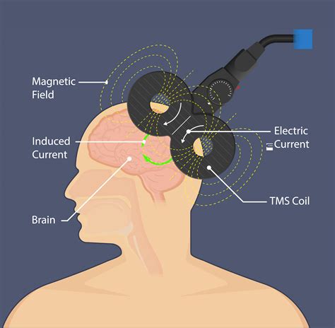 TMS Talent Management System に対する画像結果