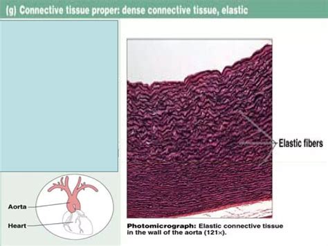 Image result for 5 Types of Connective Tissue