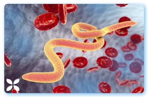 Image result for Vers Dans Les Selles