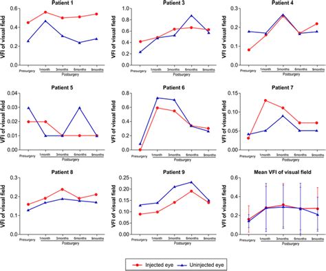 Image result for VFI Visual Field