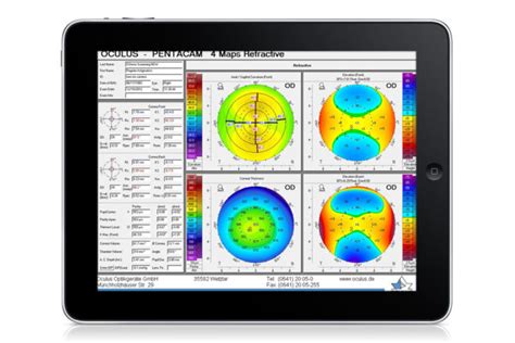 Image result for MATLAB Pentacam