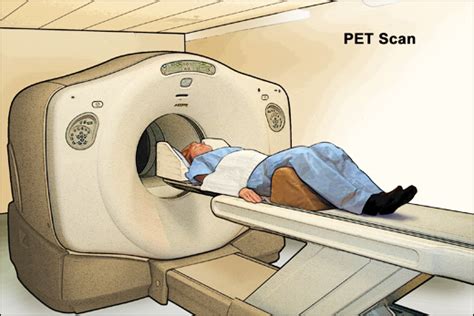 Image result for Pet Scan Process