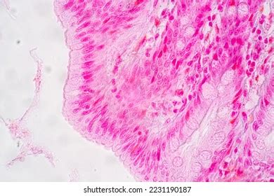 Afbeeldingsresultaten voor Human Small Intestine Tissue