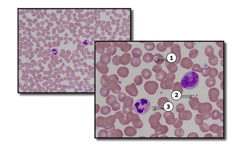 Image result for Tissue Blood Layers