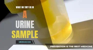 Urine Sample Testing Procedure-साठीचा प्रतिमा निकाल