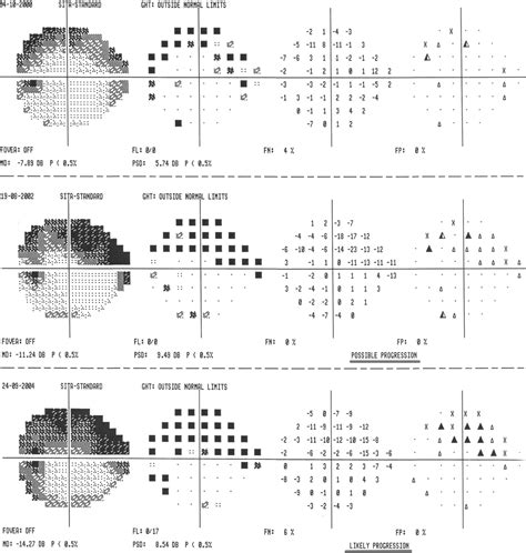 Tunnel Vision Visual Field Glaucoma に対する画像結果