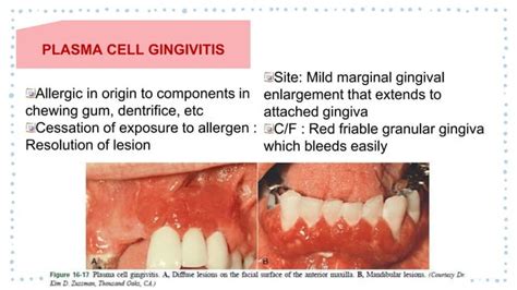 Granulation Tissue に対する画像結果
