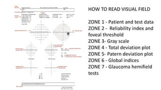 Image result for Normal Perimetry Visual Field Chart