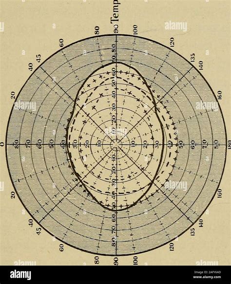 Image result for Visual Field Graph