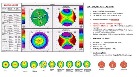 Image result for MATLAB Pentacam