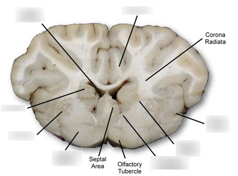 Image result for Rostral Dex